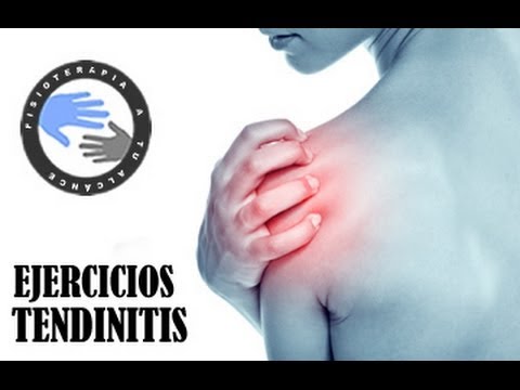 Tendinitis, ejercicios para aliviar el dolor de hombro