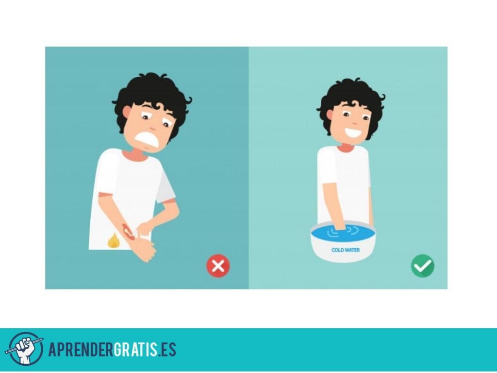 Curso para tratar las quemaduras