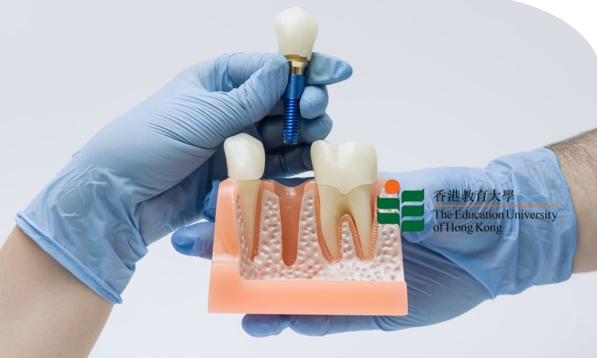 Curso online sobre implantología dental, colocación de implantes y técnicas de restauración